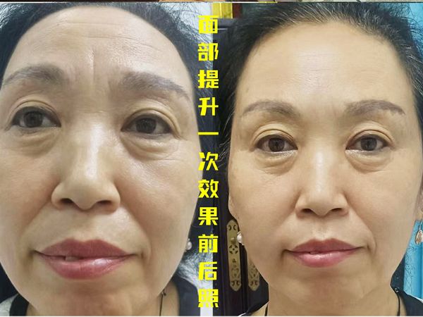 杨氏美雕专业